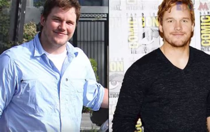 Chris Pratt Plastic Surgery Before and After