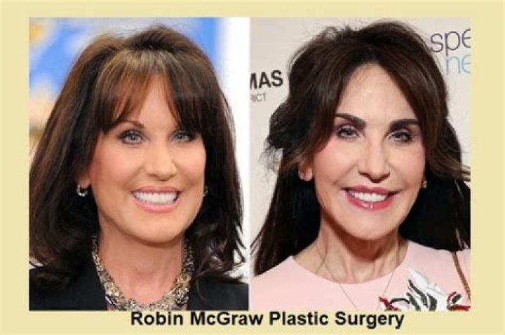 Robin McGraw Plastic Surgery: The Eyebrow Transplant That Transformed Her Look!