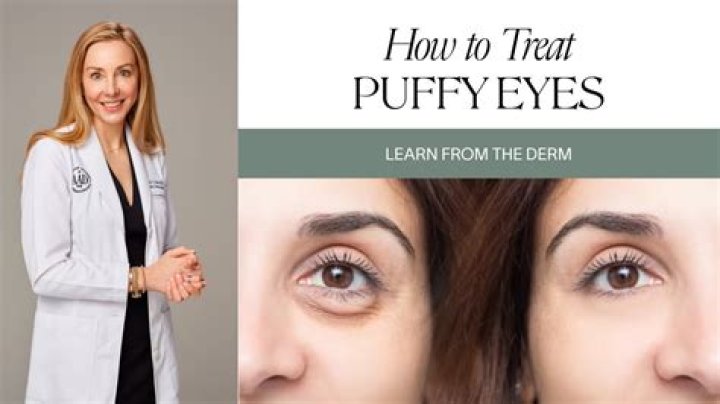 Why Are Daryl’S Eyes So Puffy? – Celebrity